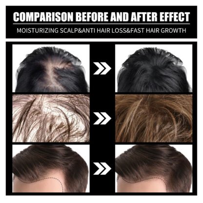 RESEARCH Liquid Biotin & Collagen Hair Growth Drops - Image 5