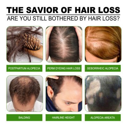 Jaysuing Hair Treatment - Image 2